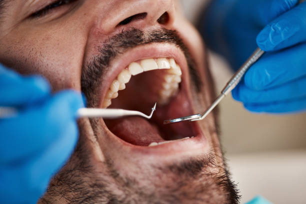 Best Cracked Tooth Emergency Dentist  in Belmont, NC